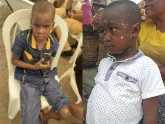 Boy who survived Lagos collapsed building is afraid of returning to school