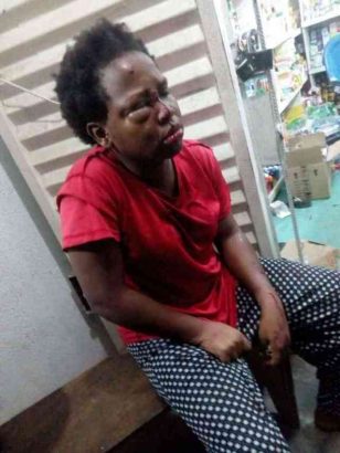 FUPRE female student robbed, stabbed multiple times lailasnews 2