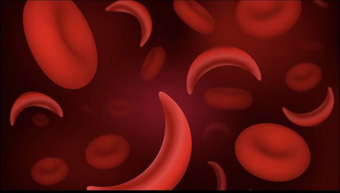 World-Sickle-cell-day